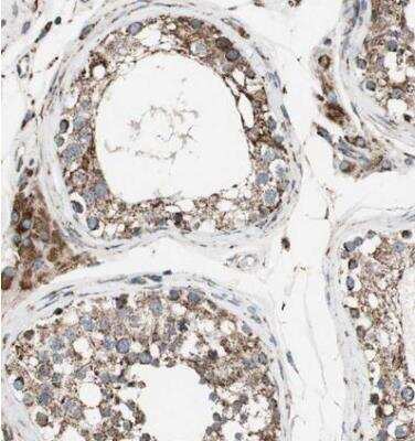 Immunohistochemistry-Paraffin: Proprotein convertase PC4 Antibody [NBP1-88010]