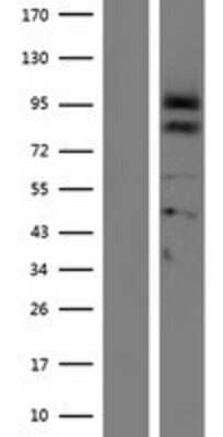 Western Blot: Proprotein convertase PC4 Overexpression Lysate [NBP2-06965]