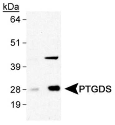 Western Blot: PGD2 Synthase/PTGDS AntibodyBSA Free [NB110-59911]