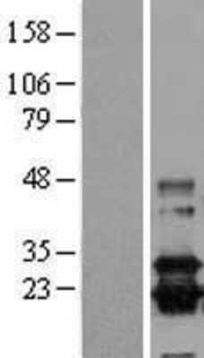 Western Blot: PGD2 Synthase/PTGDS Overexpression Lysate [NBL1-14930]