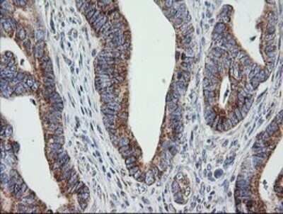 Immunohistochemistry: Prostaglandin E Synthase 2/PTGES2 Antibody (OTI2C3) - Azide and BSA Free [NBP2-73623]