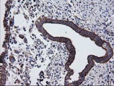 Immunohistochemistry: Prostaglandin E Synthase 2/PTGES2 Antibody (OTI2C3) - Azide and BSA Free [NBP2-73623]