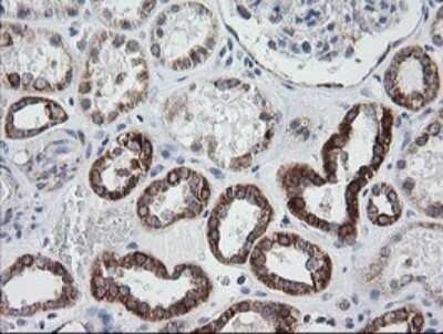 Immunohistochemistry: Prostaglandin E Synthase 2/PTGES2 Antibody (OTI2C3) - Azide and BSA Free [NBP2-73623]
