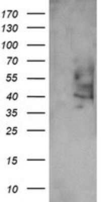 Western Blot: Prostaglandin E Synthase 2/PTGES2 Antibody (OTI2C3)Azide and BSA Free [NBP2-73623]