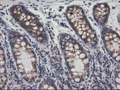 Immunohistochemistry: Prostaglandin E Synthase 2/PTGES2 Antibody (OTI2C3) [NBP2-45904]