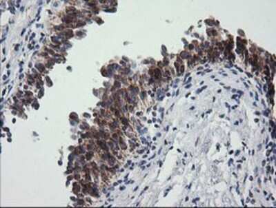 Immunohistochemistry: Prostaglandin E Synthase 2/PTGES2 Antibody (OTI2C3) [NBP2-45904]