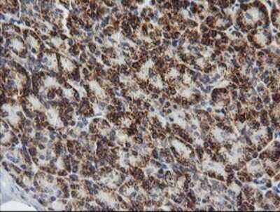 Immunohistochemistry: Prostaglandin E Synthase 2/PTGES2 Antibody (OTI2C3) [NBP2-45904]