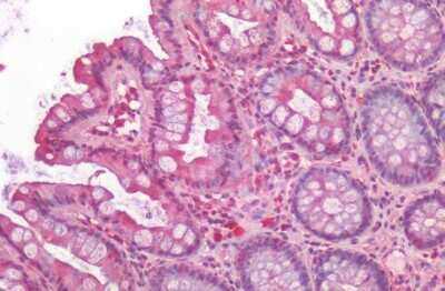 Immunohistochemistry-Paraffin: Prostaglandin E Synthase Antibody - BSA Free [NB110-39058]