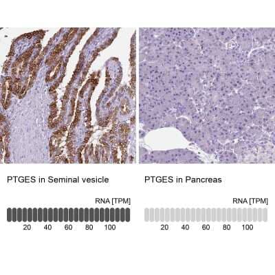 Immunohistochemistry-Paraffin: Prostaglandin E Synthase Antibody [NBP1-87852]