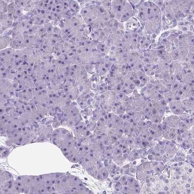 Immunohistochemistry-Paraffin: Prostaglandin E Synthase Antibody [NBP1-87852]