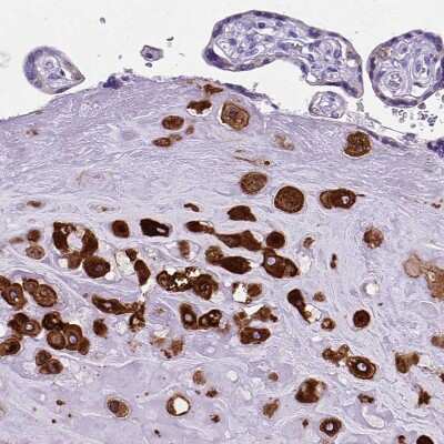 Immunohistochemistry-Paraffin: Prostaglandin E Synthase Antibody [NBP1-87852]