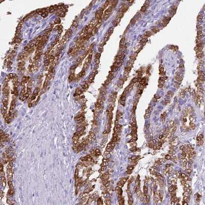 Immunohistochemistry-Paraffin: Prostaglandin E Synthase Antibody [NBP1-87852]
