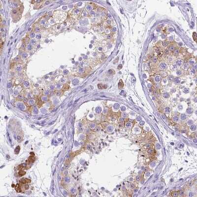 Immunohistochemistry-Paraffin: Prostaglandin E Synthase Antibody [NBP1-87852]
