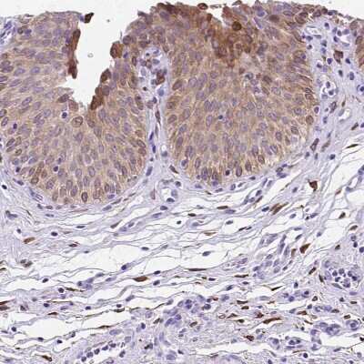 Immunohistochemistry-Paraffin: Prostaglandin E Synthase Antibody [NBP1-87852]