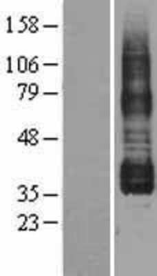 Western Blot: PTGIR Overexpression Lysate [NBL1-14939]