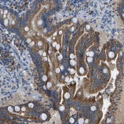 Immunohistochemistry-Paraffin: Prostaglandin I2 Synthase Antibody [NBP1-85359]