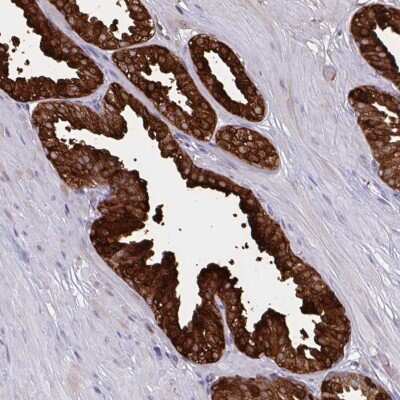 Immunohistochemistry-Paraffin: PSP94/MSMB Antibody [NBP2-33610]