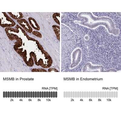 Immunohistochemistry-Paraffin: PSP94/MSMB Antibody [NBP2-33610]