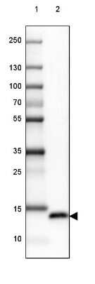 Western Blot: PSP94/MSMB Antibody [NBP2-33610]