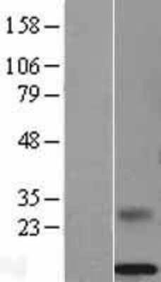 Western Blot: PSP94/MSMB Overexpression Lysate [NBL1-13333]