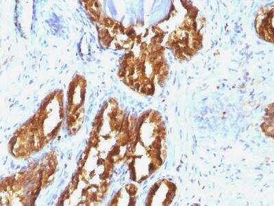 Immunohistochemistry-Paraffin: Prostatic Acid Phosphatase/ACPP Antibody (ACPP/1338) [NBP2-47631]