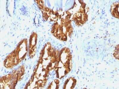 Immunohistochemistry-Paraffin: Prostatic Acid Phosphatase/ACPP Antibody (ACPP/1338) - Azide and BSA Free [NBP2-54308]