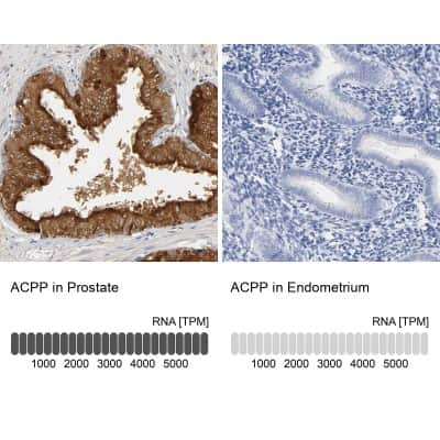 Immunohistochemistry-Paraffin: Prostatic Acid Phosphatase/ACPP Antibody [NBP1-90263]