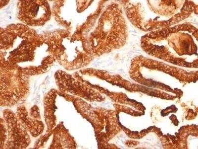 Immunohistochemistry-Paraffin: Prostatic Acid Phosphatase/ACPP Antibody (SPM312) [NBP2-53169]