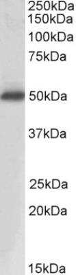 Western Blot: Prostatic Acid Phosphatase/ACPP Antibody [NBP1-51946]