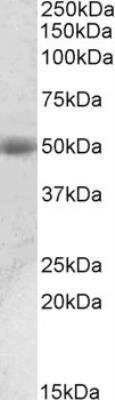 Western Blot: Prostatic Acid Phosphatase/ACPP Antibody [NBP1-78280]