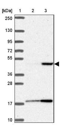 Western Blot: Prostatic Acid Phosphatase/ACPP Antibody [NBP2-39012]