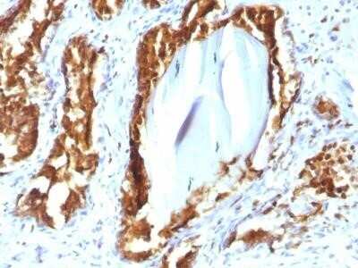 Immunohistochemistry-Paraffin: Prostatic Acid Phosphatase/ACPP Antibody (rACPP/1338) - Azide and BSA Free [NBP2-75777]