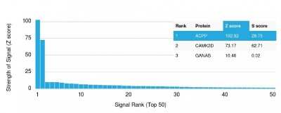 Protein Array: Prostatic Acid Phosphatase/ACPP Antibody (rACPP/1338) [NBP2-75776]