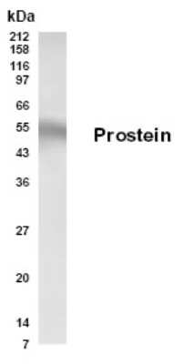 Western Blot: SLC45A3/Prostein AntibodyBSA Free [NB200-129]