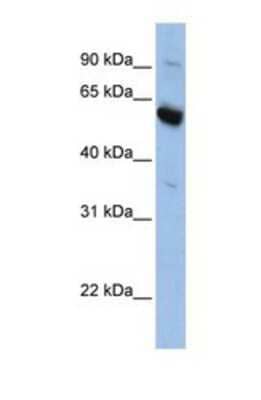 Western Blot: SLC45A3/Prostein Antibody [NBP1-69294]