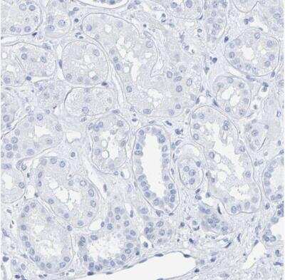 Immunohistochemistry-Paraffin: Prosurfactant Protein C Antibody [NBP1-87201]