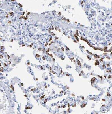 Immunohistochemistry-Paraffin: Prosurfactant Protein C Antibody [NBP1-87201]