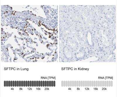 Immunohistochemistry-Paraffin: Prosurfactant Protein C Antibody [NBP1-87201]