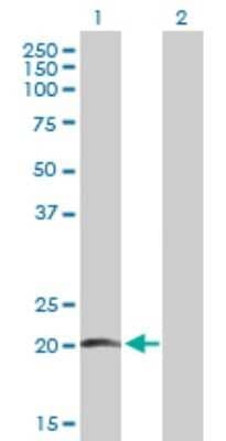 Western Blot: Prosurfactant Protein C Antibody [H00006440-B01P]