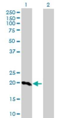 Western Blot: Prosurfactant Protein C Antibody [H00006440-D01P]