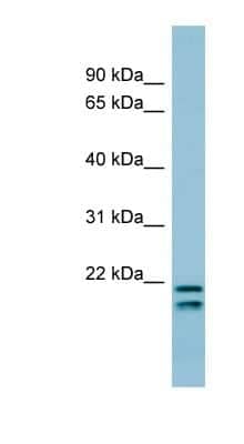 Western Blot: Prosurfactant Protein C Antibody [NBP1-60117]