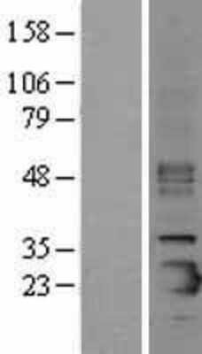 Western Blot: Prosurfactant Protein C Overexpression Lysate [NBL1-15896]