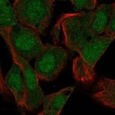 Immunocytochemistry/ Immunofluorescence: Protamine 1 Antibody [NBP3-17420]