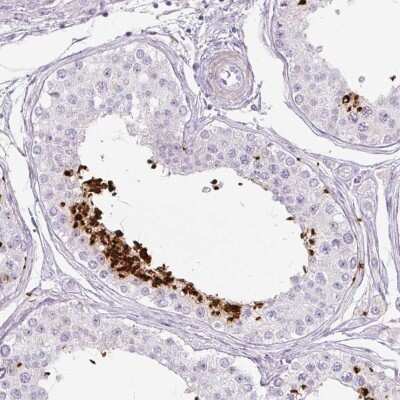 Immunohistochemistry-Paraffin: Protamine 1 Antibody [NBP2-30949]