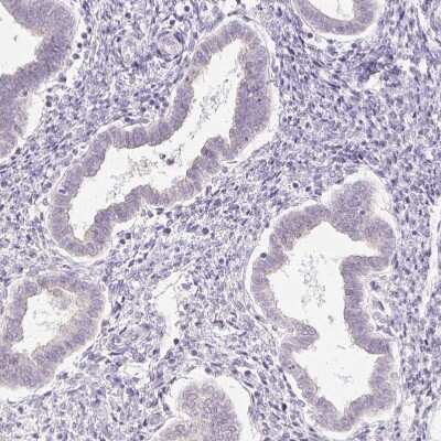 Immunohistochemistry-Paraffin: Protamine 1 Antibody [NBP2-30949]