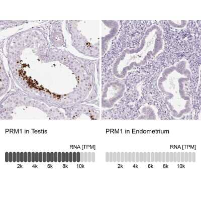 Immunohistochemistry-Paraffin: Protamine 1 Antibody [NBP2-30949]