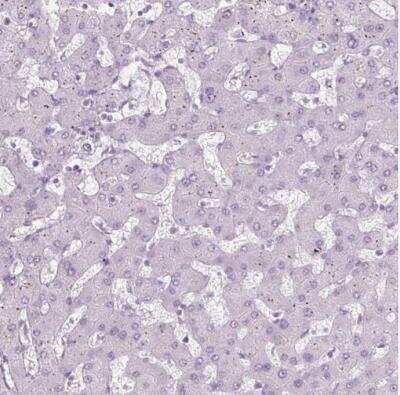 Immunohistochemistry-Paraffin: Protamine 1 Antibody [NBP2-30949]