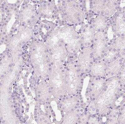 Immunohistochemistry-Paraffin: Protamine 1 Antibody [NBP2-30949]