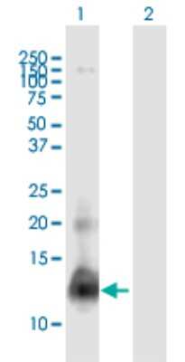 Western Blot: Protamine 1 Antibody [H00005619-B01P]