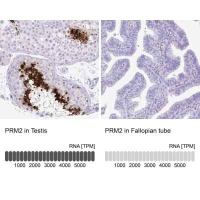 Immunohistochemistry-Paraffin: Protamine 2 Antibody [NBP2-31637]